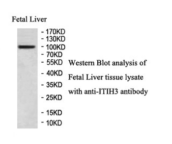 ITIH3 Rabbit Polyclonal Antibody