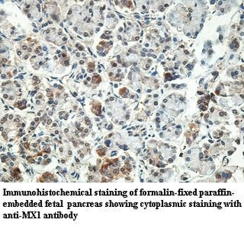 MX1 Rabbit Polyclonal Antibody