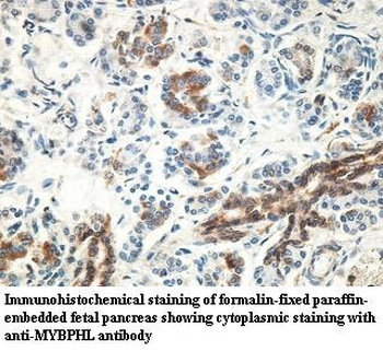 MYBPHL Rabbit Polyclonal Antibody