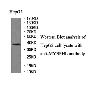 MYBPHL Rabbit Polyclonal Antibody
