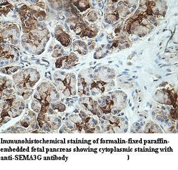 SEMA3G Rabbit Polyclonal Antibody