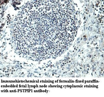 PSTPIP1 Rabbit Polyclonal Antibody