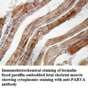 PARVA Rabbit Polyclonal Antibody