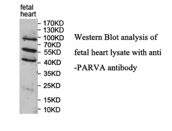 PARVA Rabbit Polyclonal Antibody