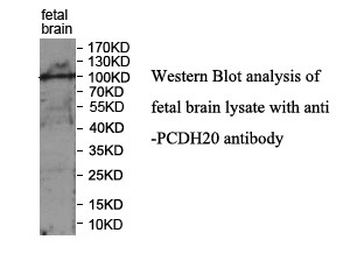 PCDH20 Rabbit Polyclonal Antibody