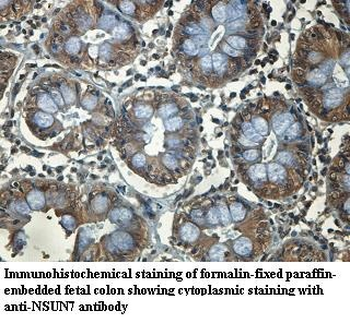 NSUN7 Rabbit Polyclonal Antibody