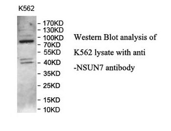 NSUN7 Rabbit Polyclonal Antibody