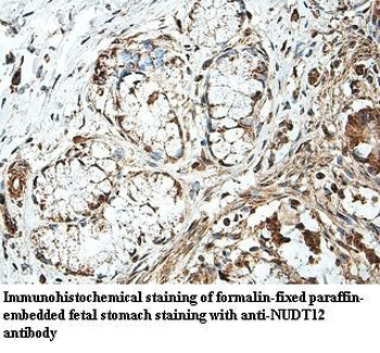 NUDT12 Rabbit Polyclonal Antibody