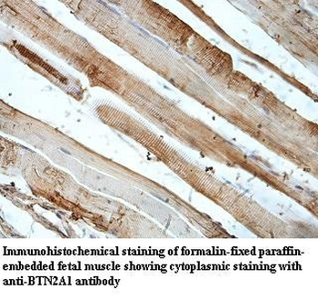 BTN2A1 Rabbit Polyclonal Antibody