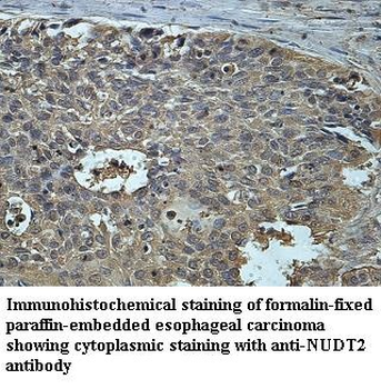 NUDT2 Rabbit Polyclonal Antibody