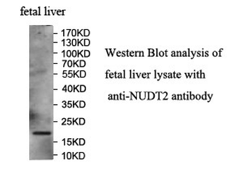 NUDT2 Rabbit Polyclonal Antibody