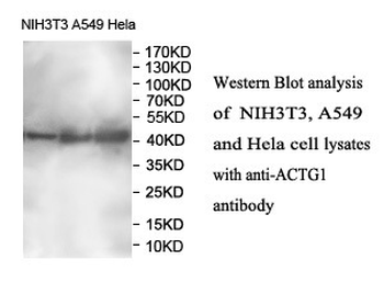 ACTG1 Rabbit Polyclonal Antibody