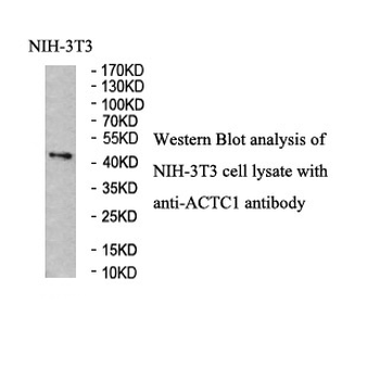 ACTC1 Rabbit Polyclonal Antibody