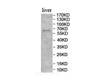 BCMO1 Rabbit Polyclonal Antibody