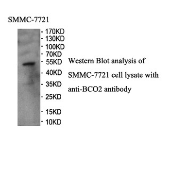 BCO2 Rabbit Polyclonal Antibody