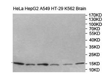 ATP6V1G2 Rabbit Polyclonal Antibody