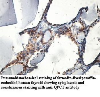 QPCT Rabbit Polyclonal Antibody