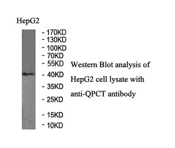 QPCT Rabbit Polyclonal Antibody