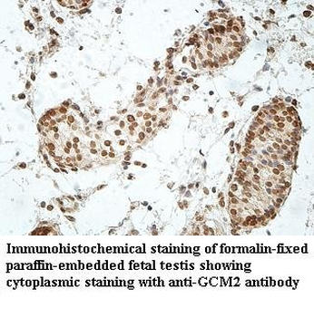 GCM2 Rabbit Polyclonal Antibody