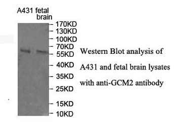 GCM2 Rabbit Polyclonal Antibody