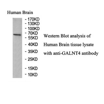 GALNT4 Rabbit Polyclonal Antibody