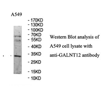 GALNT12 Rabbit Polyclonal Antibody