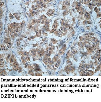 DZIP1L Rabbit Polyclonal Antibody