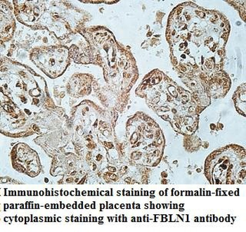 FBLN1 Rabbit Polyclonal Antibody