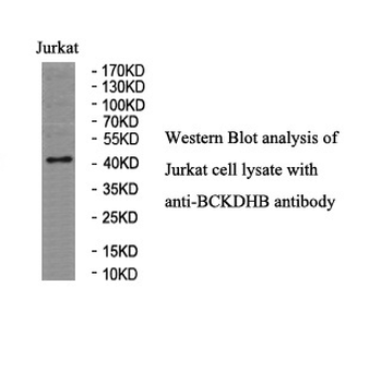 BCKDHB Rabbit Polyclonal Antibody