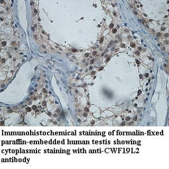 CWF19L2 Rabbit Polyclonal Antibody