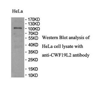 CWF19L2 Rabbit Polyclonal Antibody