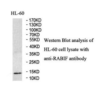 RABIF Rabbit Polyclonal Antibody