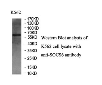 SOCS6 Rabbit Polyclonal Antibody
