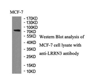 LRRN3 Rabbit Polyclonal Antibody