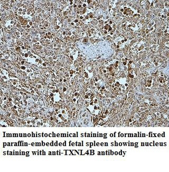 TXNL4B Rabbit Polyclonal Antibody