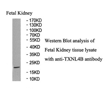 TXNL4B Rabbit Polyclonal Antibody