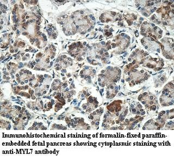 MYL7 Rabbit Polyclonal Antibody