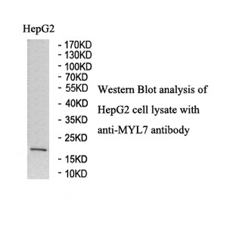 MYL7 Rabbit Polyclonal Antibody