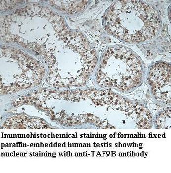TAF9B Rabbit Polyclonal Antibody