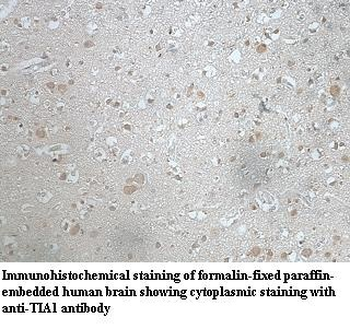 TIA1 Rabbit Polyclonal Antibody