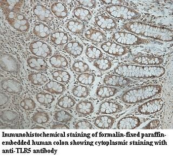 TLR5 Rabbit Polyclonal Antibody