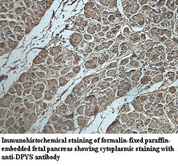 DPYS Rabbit Polyclonal Antibody