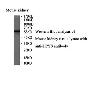 DPYS Rabbit Polyclonal Antibody