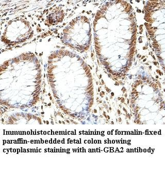 GBA2 Rabbit Polyclonal Antibody