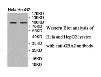 GBA2 Rabbit Polyclonal Antibody