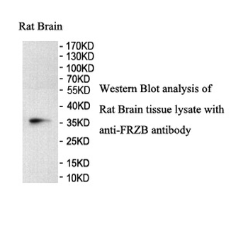 FRZB Rabbit Polyclonal Antibody