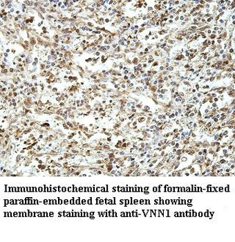 VNN1 Rabbit Polyclonal Antibody