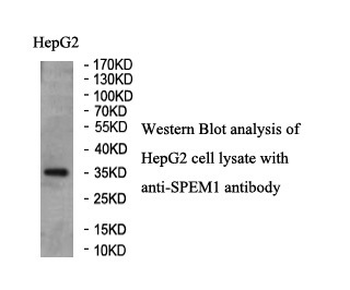 SPEM1 Rabbit Polyclonal Antibody