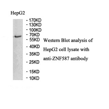 ZNF587 Rabbit Polyclonal Antibody
