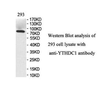 YTHDC1 Rabbit Polyclonal Antibody